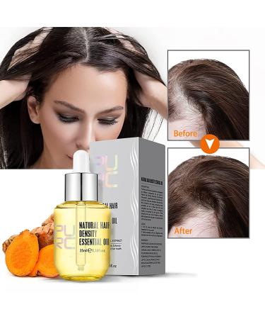 ZRIPOV Hair Growth Essential Oil - Natural Hair Regrowth Solution for Men & Women - 1.18 Fl Oz - Buy Online on GoSupps.com