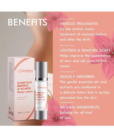 STRETCH MARK REMOVER - SCARS BODY LOTION - Firming Body Lotion Infused with Essential Oils and Extracts to Improve the Appearance of Scars Stretch Marks and Uneven Skin Tone - 50 ml - Buy Online on GoSupps.com