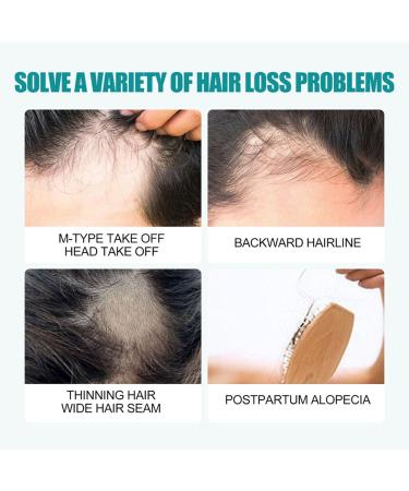 The Ordinary Multi-Peptide Hair Density Serum 60ml | Vegan Hair Growth Serum for Men & Women | Best for Volume & Density | Order 1-3 Pieces Online - Buy Online on GoSupps.com