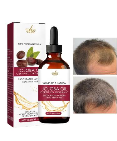 Regrow Hair Oil Natural hair growth oil for thinning hair and bald spots Revitalizing and strengthening scalp treatment promotes healthy prevents hair loss and nourishes - Buy Online on GoSupps.com