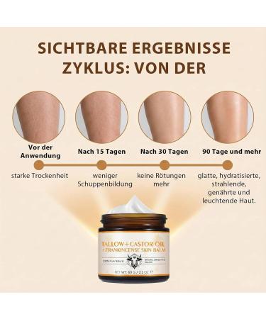 LHUDILS Tallow Bee Cream Bienengiftsalbe 130g Face Care AntiAging Wrinkle Reduction Muscle Pain Relief MindBody Improvement Bienengiftsalbe Moisturizing Skin Rejuvenation Tallow Creme - Buy Online on GoSupps.com