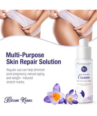 Bloom Krans Stretch Mark Cream for Pregnancy | Moisturizing Stretch Mark Remover & Prevention Lotion for Pregnant Belly & Postpartum Essentials - Buy Online on GoSupps.com
