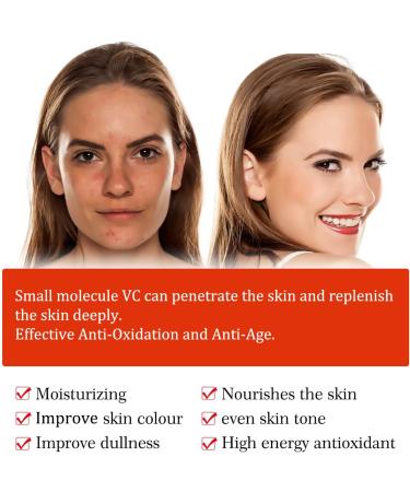 Vitamin C Serum For Face Serum 10% Fresh Vitamin C + 5% Sweet Orange Extract with Hyaluronic Acid For Face Hydrate Skin & Even Skin Tone Anti Aging & Wrinkle Face Serum for Women - Buy Online on GoSupps.com