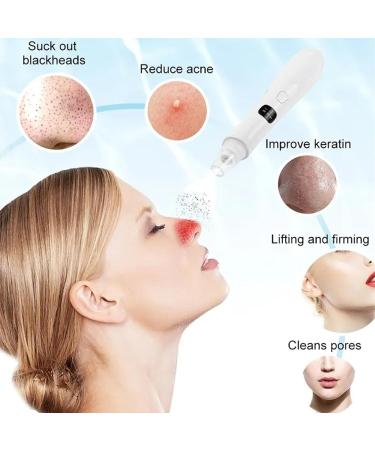 Blackhead Extractor Blackhead Remover Skin Tag Removal Kit with 5 Probes Pore Extractor Portable Pimple Extractor Rechargeable USB Port 3 Speeds Control for Women and Men White - Buy Online on GoSupps.com