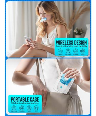 Nicwell Teeth Whitening Kit for Sensitive Tooth: 3 x 35% Carbamide Peroxide Gel & 1 Safe Remineralizing Pen - Teeth whitening LED light for Glow Gen Aged 18-34 - Oral Care for Dentist Office Daily use - Buy Online on GoSupps.com