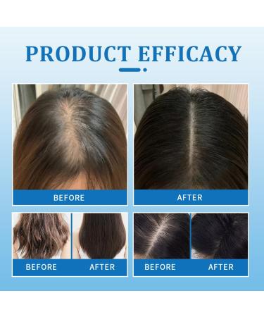 2 X Scalp Cooling Hair Ampoule Hair Serum Roll-On Serum Capillaire Roll-On Renforce Les Racines Stimule La Pousse Anti-Chute & Volume - Buy Online on GoSupps.com