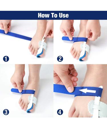 Buy Bunion Splint & Orthopedic Corrector | Adjustable Big Toe Straightener for Men & Women - International Shipping - Buy Online on GoSupps.com
