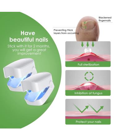 2 Pack Nail Fungus Cleaning Laser Therapy - Rechargeable, Effective Treatment for Damaged Discolored Thick Toenails & Fingernails - Buy Online on GoSupps.com
