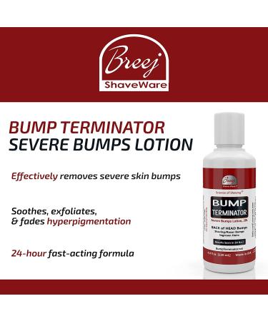 Bump Terminator Severe Bumps Lotion (4oz) - Fast Relief for Razor Bumps - Buy Online on GoSupps.com
