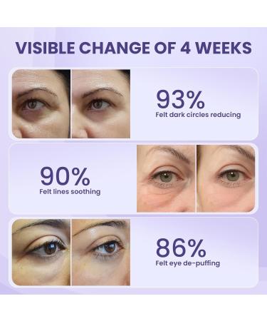 Retinol Eye Cream - Anti-Aging Under Eye Treatment for Dark Circles & Puffiness with Lotus Leaf Extract | Made in USA - Buy Online on GoSupps.com