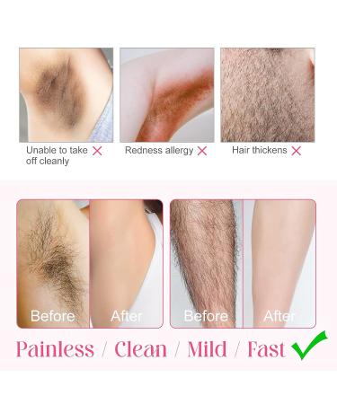 Intimate Hair Removal Cream for Women and Men - Effective & Painless Depilatory Cream for Private Areas, Bikini, Body, Legs, Underarms - All Skin Types - 60g - Buy Online on GoSupps.com