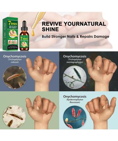  Generisch Nail Oil for Growth and Strength | Light Natural Nail Gel 30ml - Fortifying Care Gel - Natural Home Repair - Suitable for Family Stressed Nails - Buy Online on GoSupps.com