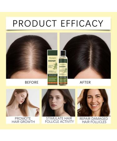 Shampoing nourrissant pour femmes traitement de soin du cuir chevelu 100 ml formule de r paration des cheveux secs avec extraits naturels plateforme de soins capillaires au design compact formule - Buy Online on GoSupps.com