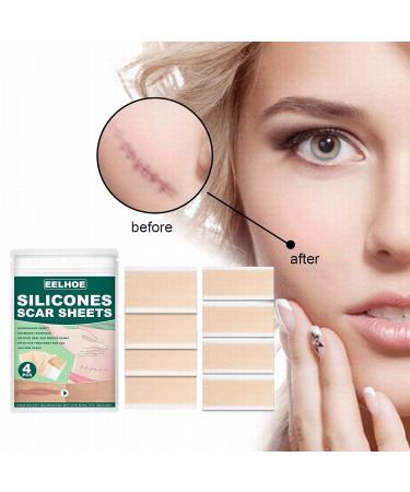 Super Facial Silicone Gel Scar Patch - Fades Stretch Marks & Burn Scars - Smooth Skin - My Orders - One Size B - Buy Online on GoSupps.com