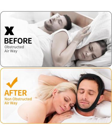 Veralabs Adjustable Airflow Jaw Strap - Breathable Chin Strap for Better Sleep | 2PCS (Black - Buy Online on GoSupps.com