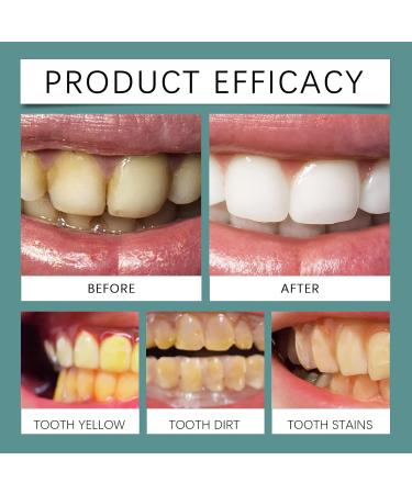 Mint Fresh Care Toothpaste - Gum Care Stain/Tartar Removal Fresh Breath Bright Teeth(2PCS) - Buy Online on GoSupps.com