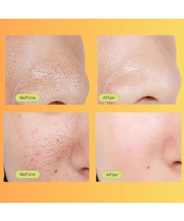 Luelle Pore Minimizer Facial Essence for Minimizing the Appearance of Pores Pore Minimizer Serum for Face Even Skin Tone Relieving Dryness Oil Control Firming - Buy Online on GoSupps.com