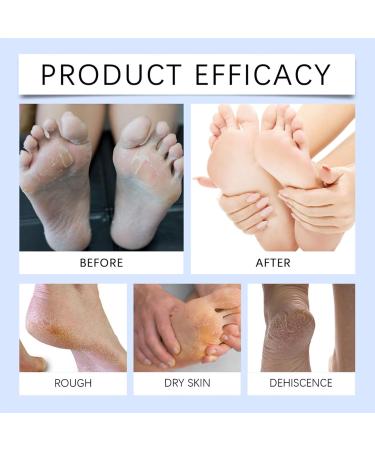  Generisch Foot cream - Long-lasting moisturizing cream - Light skin care for hands and feet - Repairing cream for very dry feet cracked heels bunions and foot odor - Buy Online on GoSupps.com