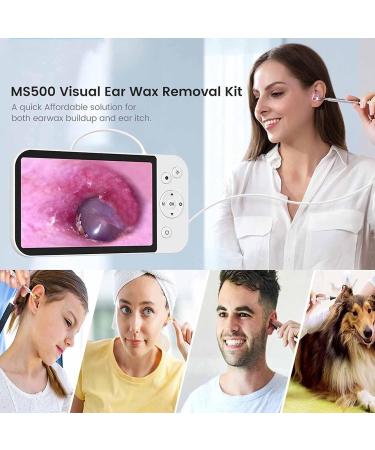 HSRG Portable USB Digital Photo Camera & 5-Inch 1080p HD Ear Cleaner - Visual Ear Cleaning Tool for Adults Children & Pets - Buy Online on GoSupps.com