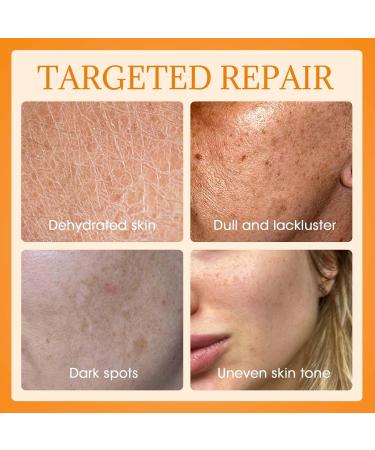 MQ Vitamin C Cream Visibly Brightening Body Lotion | Vitamin C Moisturizer Care Body Cream Revitalizes Dull-Looking Skin Promotes A Glowing Complexion - Buy Online on GoSupps.com