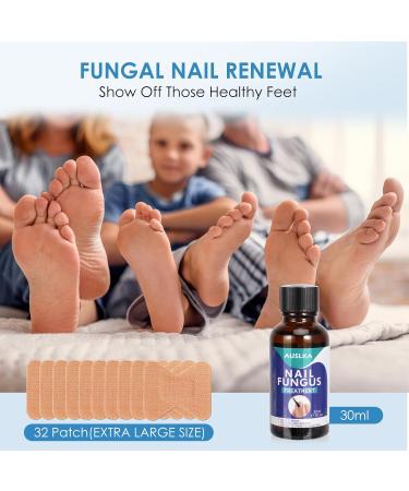 AUSLKA Toenail Fungus Treatment | Nail Renewal Solution for Discolored & Damaged Nails (32 Patches + 1 FL/OZ) - Fast & Easy Repair - Buy Online on GoSupps.com