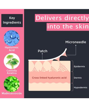 Micro Needle Patch Wavy Line - 6 Anti-Wrinkle Patches for Forehead Eye Folds & More | International Shipping - Buy Online on GoSupps.com