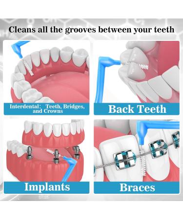 20 Interdental Brushes - L-Shaped Toothbrushes for Between Teeth | Non-Slip Handle | Orange Blue White Pink - Ideal for Effective Tooth Cleaning - Buy Online on GoSupps.com