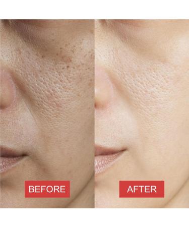 Watermelon Facial Scrub Cream - Daily Exfoliating Face Scrub for All Skin Types | Cleanses Removes Dead Skin Blackheads & Acne (10.58 OZ - Buy Online on GoSupps.com