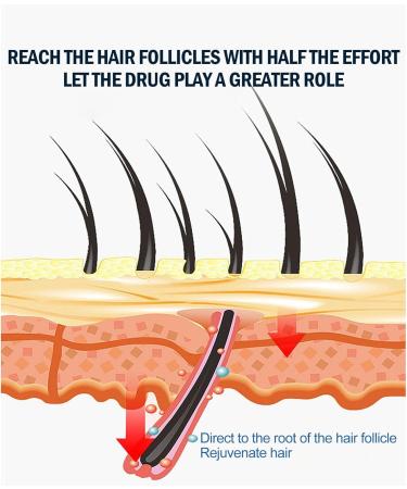 Extra Strength Hair Regrowth for Men's Hair Loss Men's Hair Growth Serum for Beard Care Serum - Buy Online on GoSupps.com