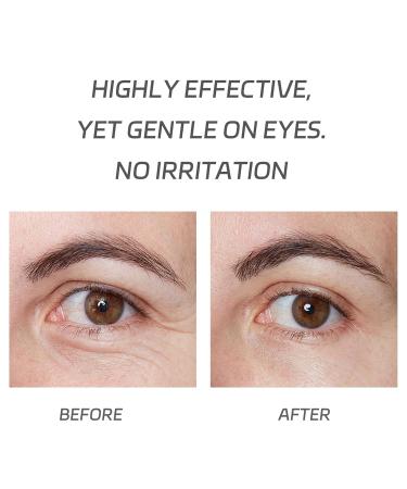 VGO Eye Cream - Dark Circles & Puffiness Repair with Pro-Xylane & 6D Hyaluronic Acid | Moisturizing Under Eye Cream - 15g/0.5oz - Buy Online on GoSupps.com
