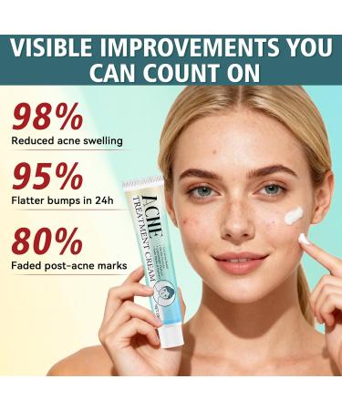 Acne Treatment for Face Acne Cream Pimple Cream Suitable for All Skin Blemish Care Cream for Face and Body Gentle Daily Skin Care for Oily & Blemish-Prone Skin Helps Improve Skin Appearance - Buy Online on GoSupps.com