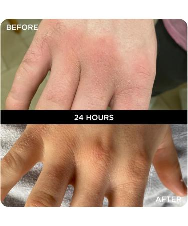 WONDERBALM LIMITED Multi Use Balm All in One Skin Cream Moisturizer for Hair Cuticles Lips and Body Moisturizing Fast Absorbing NonGreasy Olive Oil Shea Butter Vegan Natural Ingredients 20 ml - Buy Online on GoSupps.com