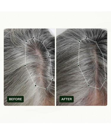 Scandinavian Biolabs Hair Strength Shampoo & Bio-Pilixin Serum for Women | Strengthen & Moisturize Hair with Gentle Clean Formula - International Shipping Available - Buy Online on GoSupps.com