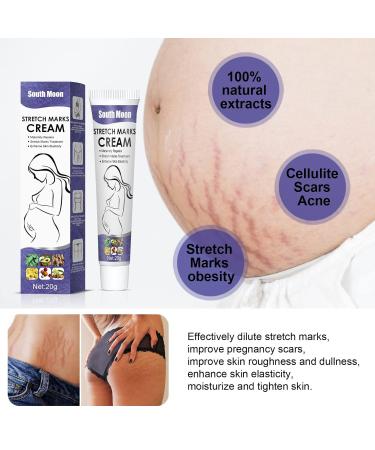 SINGOVE Scar Removal Cream - All-Natural Maternity Stretch Mark Prevention & Remover for Pregnant Women - Fades Scars, Wrinkles & Promotes Healthy Skin - Perfect Skincare Gift for Moms - One Size - Buy Online on GoSupps.com