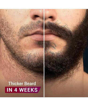 SODEN Advanced Beard Growth Oil - 2 x 30 ml | Stimulate Root & Follicle for Thicker Beards - Buy Online on GoSupps.com