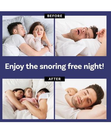 Anti-Snoring Nose Clip - Silicone Magnetic Device for Snore Relief - Buy Online on GoSupps.com