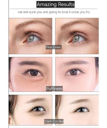 RuiLuxe Gold Collagen Gold Powder Eye Patch Gold Collagen under Eye Mask Rejuvenating Soothing Fine lines Anti Wrinkles Spa-like results Gold Eye Treatment Hydrating under Eye Gel Pads - Buy Online on GoSupps.com