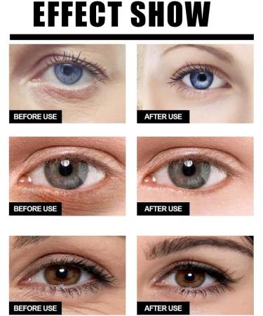 Super Serum Eye firming Rejuvenating Oil NDER EYE SERUM Eye Contour Cream - Anti-Wrinkle Anti-Puffiness & Anti-Dark Circles - With Pure Hyaluronic Acid and Caffeine (1pc) - Buy Online on GoSupps.com