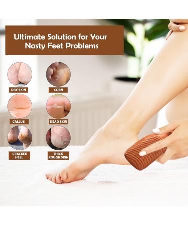 Love Natural Pumice Stone for Feet - 2-Sided Terra Cotta Exfoliating Scrubber for Callus Removal & Dead Skin Care - Buy Online on GoSupps.com