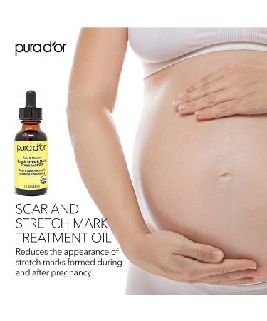 PURA DOR Organic Scar & Stretch Mark Treatment Oil | 1oz For Skin - Rosehip, Wheat Germ, Argan, Tamanu, Carrot, Rosemary, Lavender, Geranium, Patchouli, Sage - Buy Online on GoSupps.com