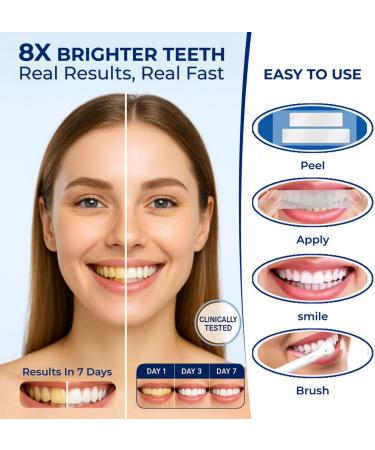 Lot de 42 bandes de blanchiment des dents sans peroxyde - Saveur menthe - N'ab me pas l' mail - Buy Online on GoSupps.com
