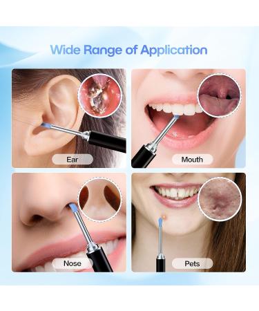 Aeasycozy Ear Wax Removal Kit with 3 Million Pixel 1296P HD Camera - Wireless Ear Cleaner with 6 LED Light & 4 Ear Sleeve Set - Buy Online on GoSupps.com