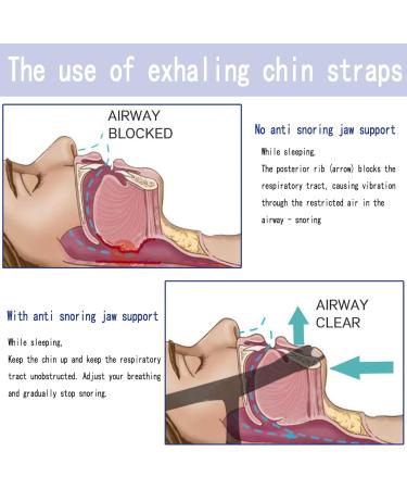 3pcs Chin Strap Anti Snoring Chin Strap Chin Strap Mouth Breathing Comfortable Aids Anti Snoring Devices Stop Snoring Snoring Aids for Men Snoring Aids for Women - Buy Online on GoSupps.com