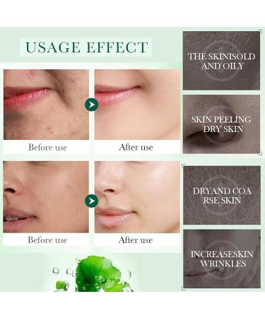 Buy Facial Serum with Hyaluronic Glycerol & Vitamin E | Exfoliates Reduces Acne & Dark Spots | International Shipping Available - Buy Online on GoSupps.com