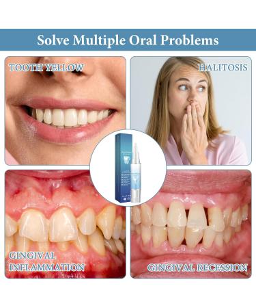 wimony Neslemy Gum Shield Therapy Gel Dentizen Gum Therapy Gel Gum Repair Treatment Gel Instant Teeth Whitening Essence Pen Deeply Cleaning Gums Teeth Whitening Enhances Overall Gum Health (4pcs) - Buy Online on GoSupps.com