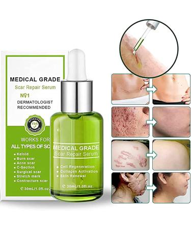 Goopgen Advanced Scar Repair Serum 30ml - Medical Grade Treatment for All Types of Scars (3PCS) - Buy Online on GoSupps.com