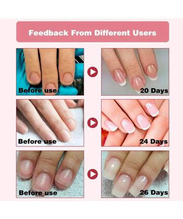 ASMAYSA Keratin 3 Day Growth Nail Treatment - Nail Strengthener and Nail Growth - Fast Keratin Nail Hardener & Nail Strengthener for Thin Nails Brittle & Damaged Maximum Strength Formula 15ml 3 Days Nail Growth - Buy Online on GoSupps.com