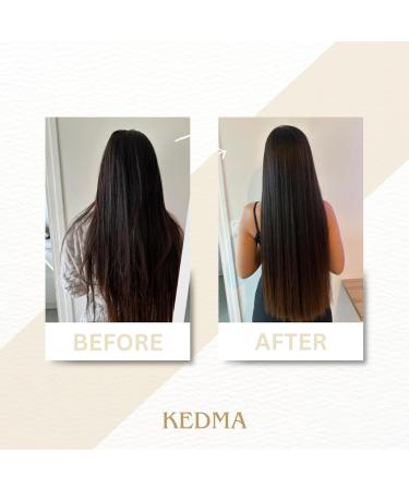 Kedma - Gommage Exfoliant Cheveux et Cuir Chevelu - Pour Cheveux Ab m s et Cuir Chevelu Sec - Purifiant Nourrissant et Revitalisant - Avec Sels de la Mer Morte - 300g - Buy Online on GoSupps.com