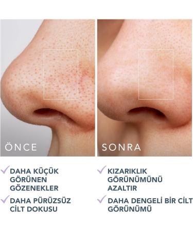 FOREO KIWI Pore Minimizing Toner Pads 60 Pieces Witch Hazel & Centella Asiatica Exfoliating Face Pads for Oil Acne Crown Skin Pore Minimizer and Redness - Buy Online on GoSupps.com