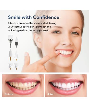 Electric Tooth Polisher Kit for Teeth Whitening & Stain Removal - Includes 5 Brush Heads and 3 Polishing Pastes - Buy Online on GoSupps.com